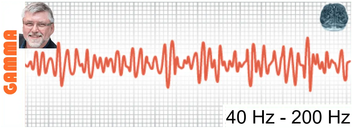Les ondes Thêta sont les plus rapides et de faible amplitude.